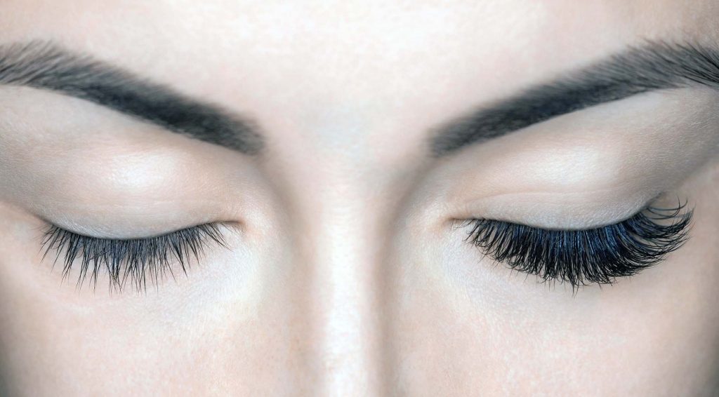 ipek ikrpik oncesi ve sonrasi