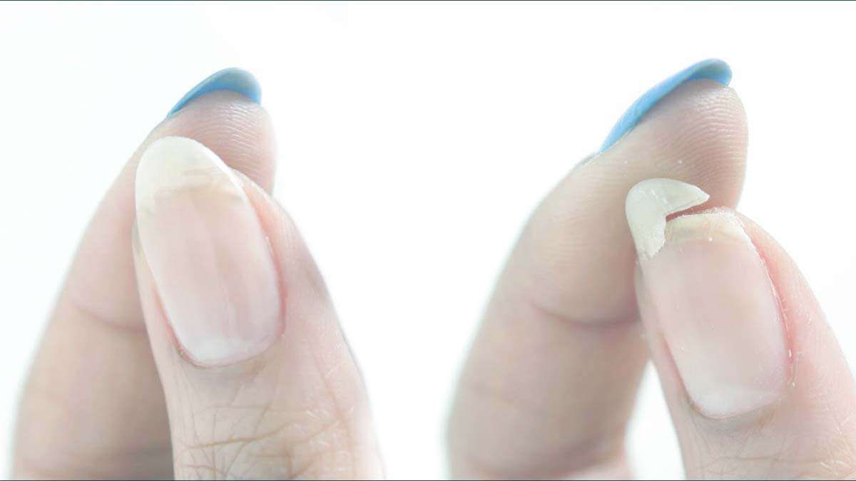 kırılan tırnak nasıl onarılır