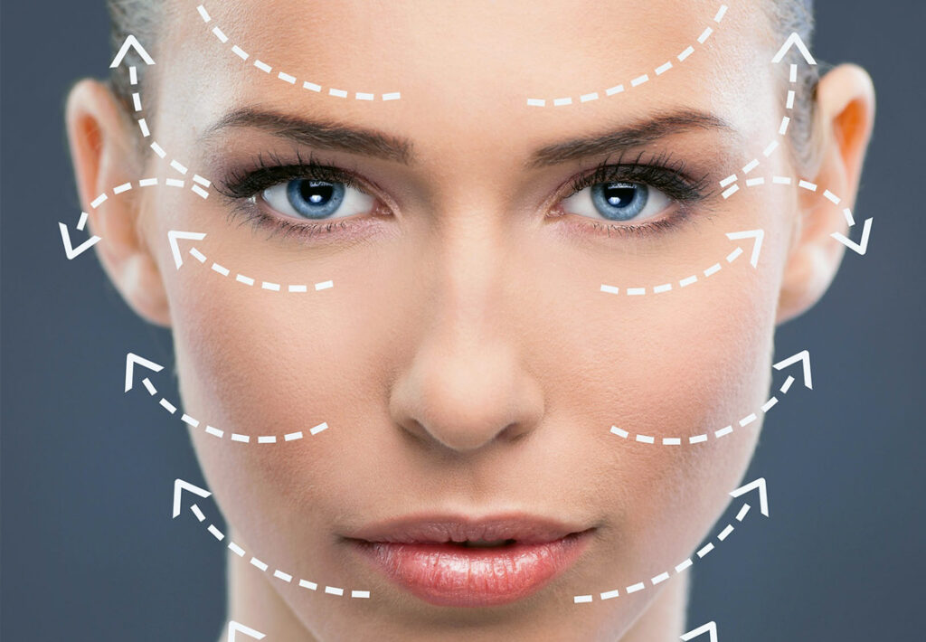 ameliyatsiz yuz germe 1