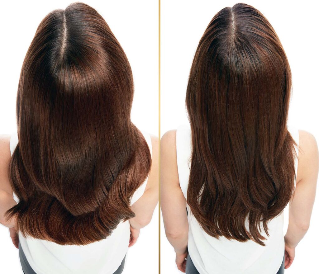 sonuk saclar icin ne yapilir