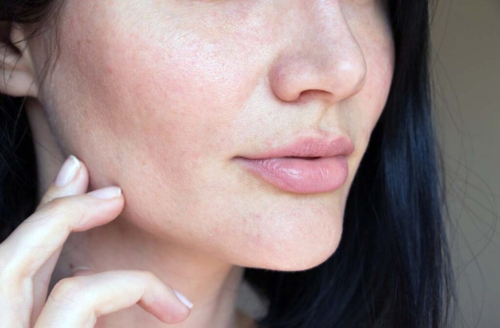 cilt tipi testi nedir? 4 yagli cilt tipi