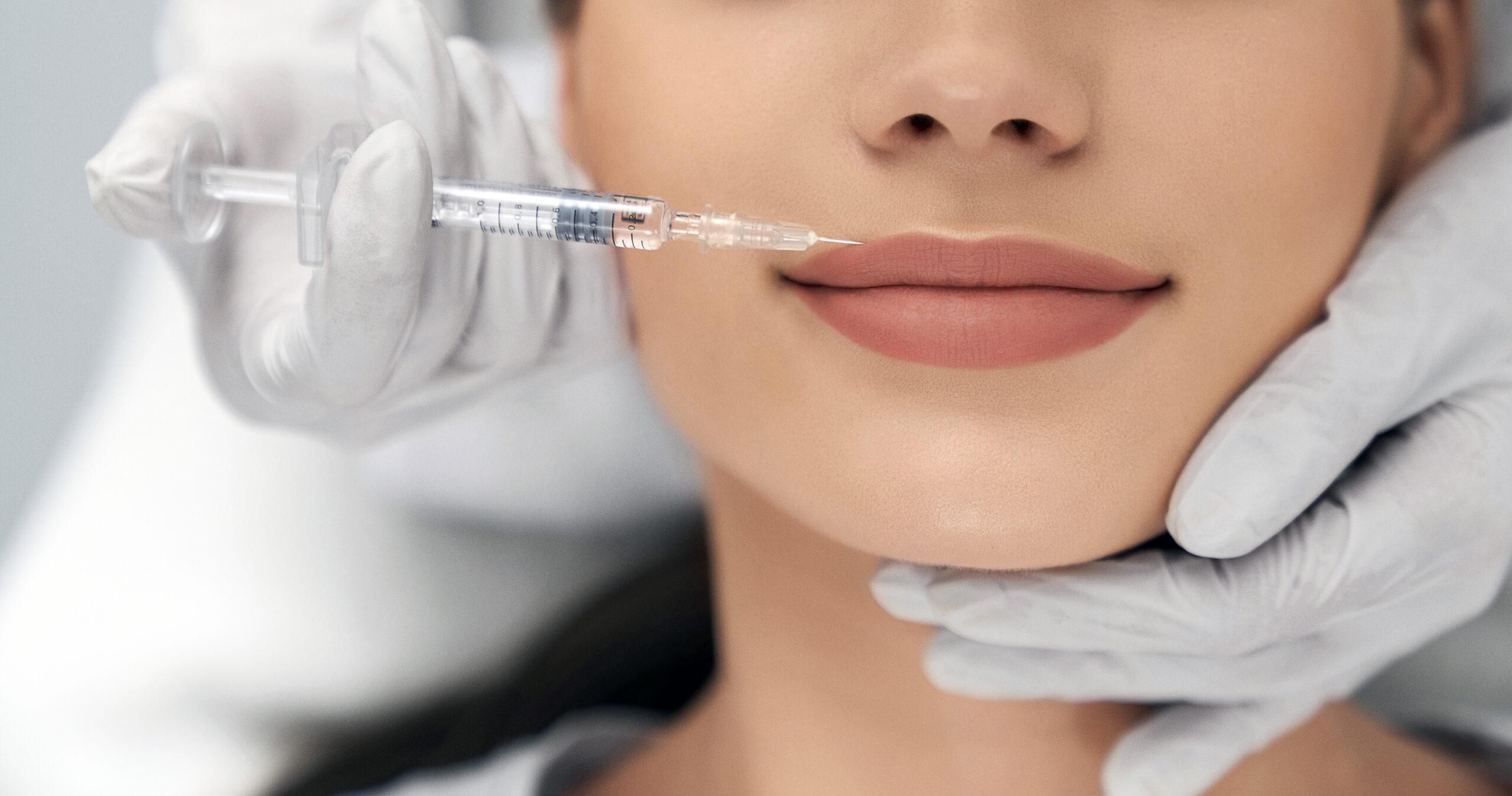 Dudak Dolgusu Hakkında Tüm Merak Edilenler 11 dudak dolgusu nasıl yapılır